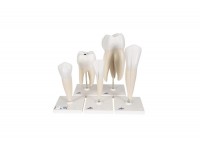 model 6-częściowego zęba trzonowego z ubytakmi, powiększony 15 razy - 1013215 [d15] 3b scientific modele anatomiczne 8
